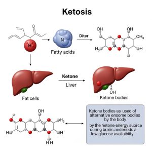 ketosis